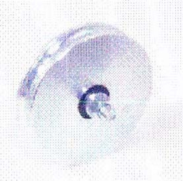 Tousek - 14330030 - Laufrolle verzinkt mit Zapfen, mit Rundrille Durchmesser 200 mm